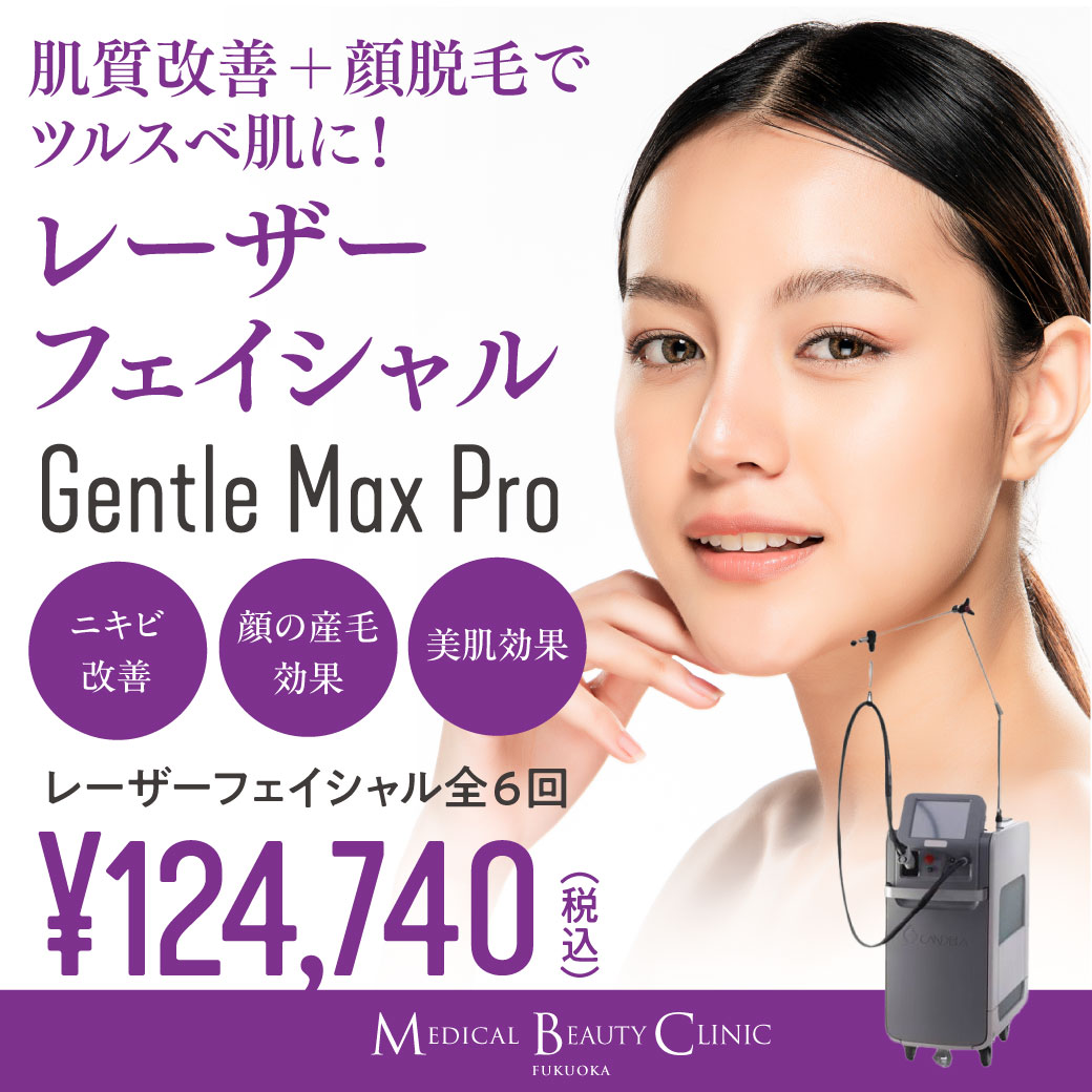 レーザーフェイシャル Gentle Max Pro